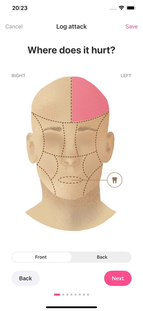 Migraine Tracker & Diary: MiG - Mapa de la cabeza en la aplicación Migraine Tracker para registrar la ubicación del dolor durante un ataque.