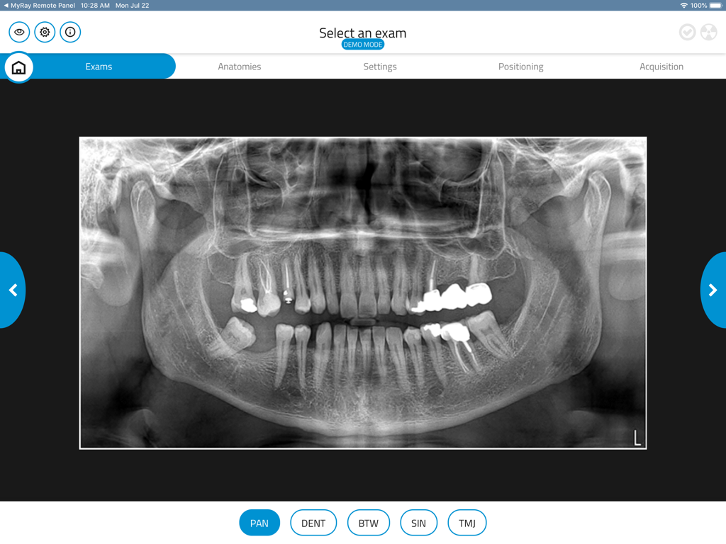 Interface do aplicativo NewTom Control Pad mostrando um exame panorâmico de raio-X odontológico em uma tela de iPad