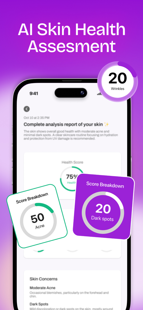 Glow Up & Skin Care AI: MAXX - MAXX app screen showing AI skin health analysis report with scores for acne dark spots and wrinkles