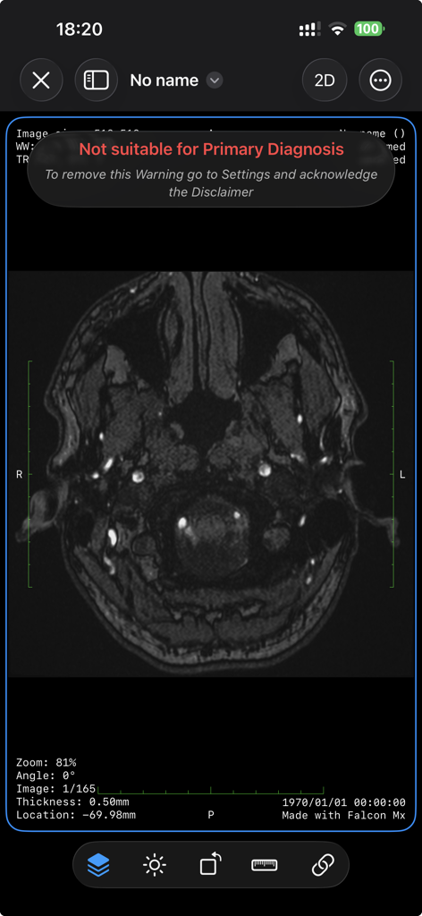 Falcon Mx - Falcon Mx mobile DICOM viewer interface displaying a brain scan with a regulatory warning message