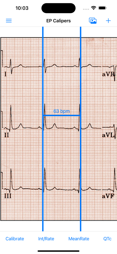 Digital calipers measuring heart rate on an ECG image