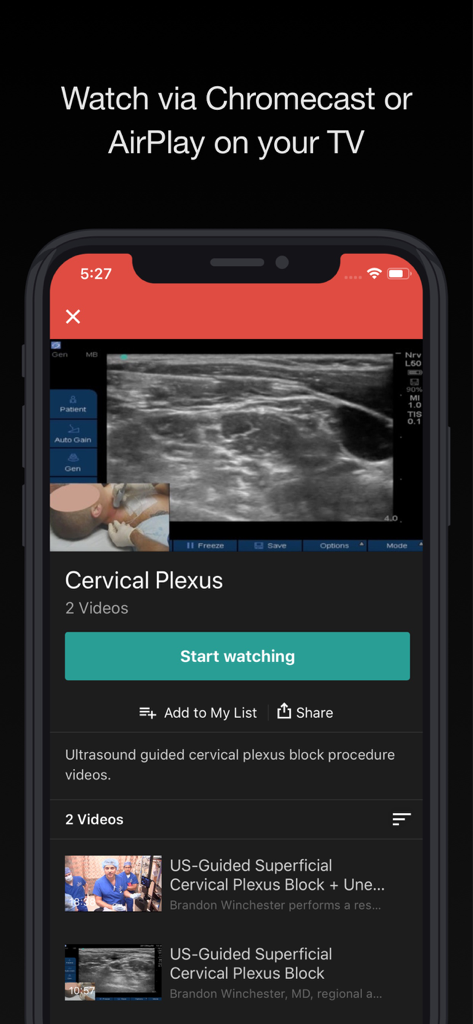BLOCKJOCKS - BLOCKJOCKS App-Bildschirm, der Lehrvideos zur ultraschallgeführten Regionalanästhesie für Zervikalplexus-Blöcke zeigt.