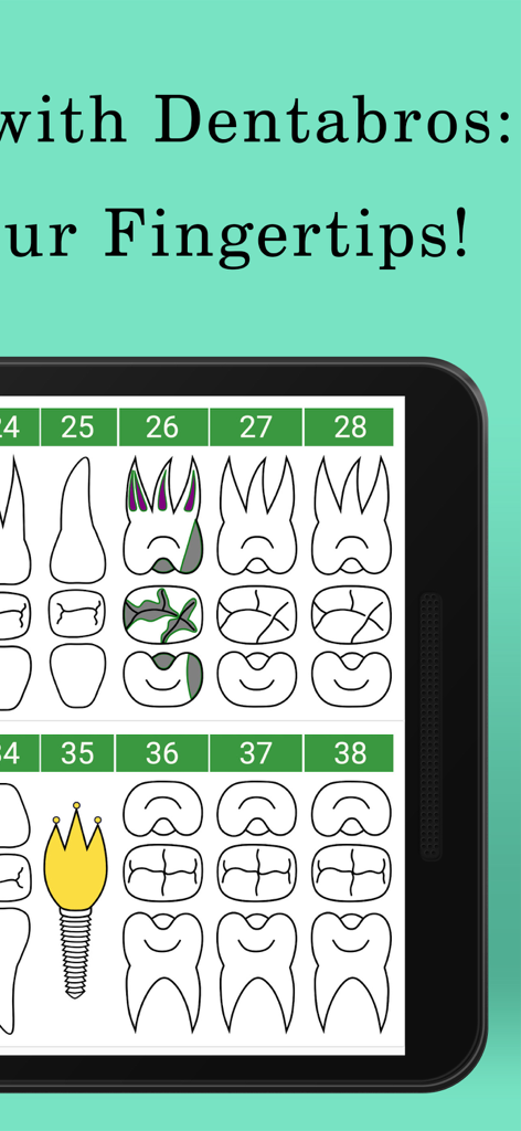 Dentabros - Dental Software - 치과 진료 관리를 위한 치아 다이어그램 및 번호 지정을 보여주는 태블릿 화면의 디지털 치과 차트