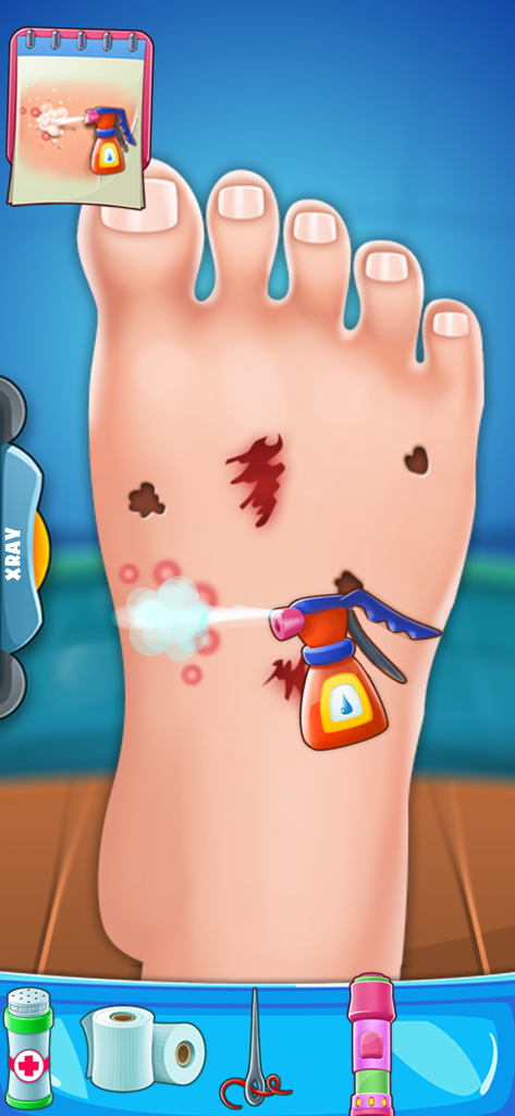 Medical Doctor Hospital Games - Tratando um pé de desenho animado com spray médico em um jogo de simulação de médico