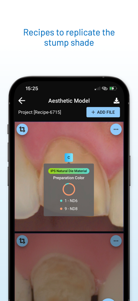 Matisse | Shade Matching - Matisse app interface displaying a recipe for replicating the stump shade in dental restorations