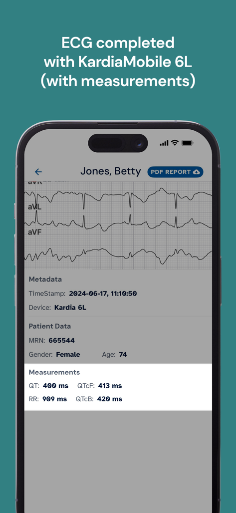 KardiaStation Professional - Interfaz clínica de KardiaStation Professional que muestra formas de onda de ECG de 6 derivaciones y mediciones cardíacas del paciente