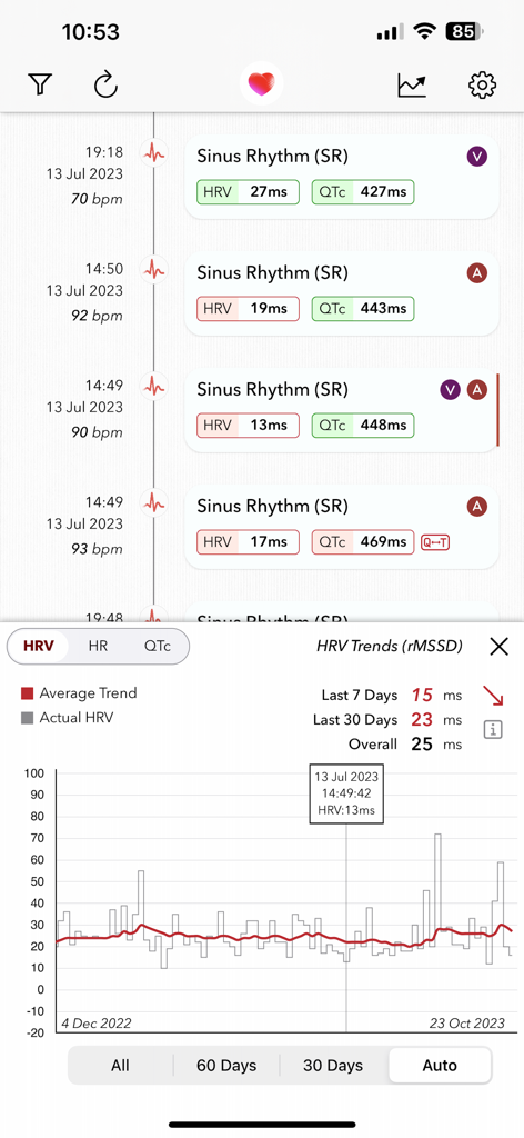 ECG+ | Your Watch ECG Reader - ECG plus app dashboard displaying heart rate variability trends and sinus rhythm records