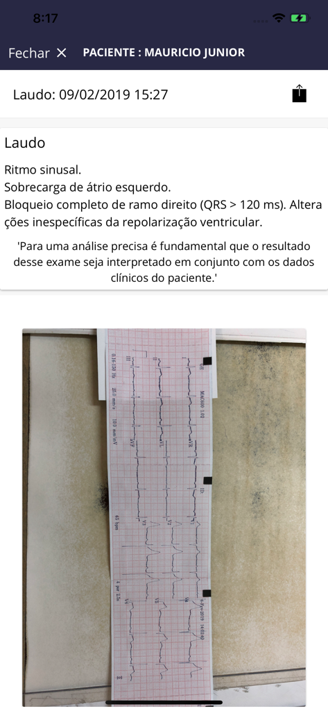 ECG com Laudo - Uma tela de relatório médico no aplicativo ECG com Laudo exibindo achados de cardiologia e uma foto de uma tira de ECG.
