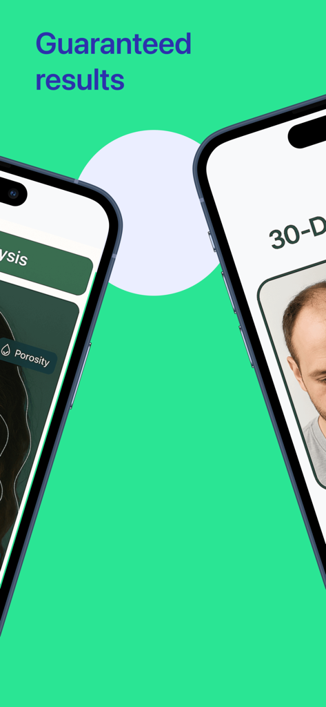 Hairmony mobile app screens displaying AI hair porosity analysis and 30 day progress tracking for hair growth