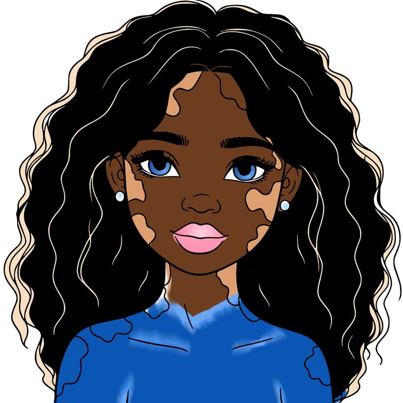 beautiful black girl with vitiligo
