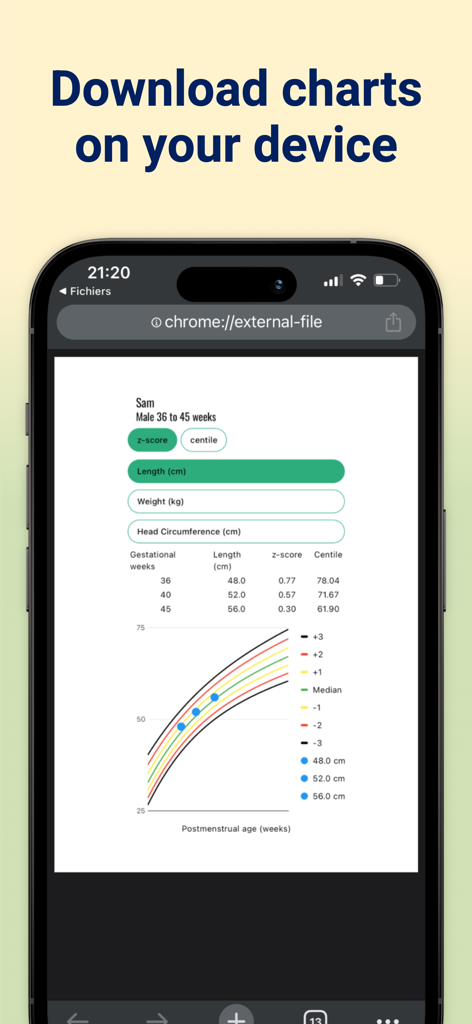 INTERGROWTH-21st - A clinical growth chart for a preterm infant showing length data plotted against postmenstrual age weeks