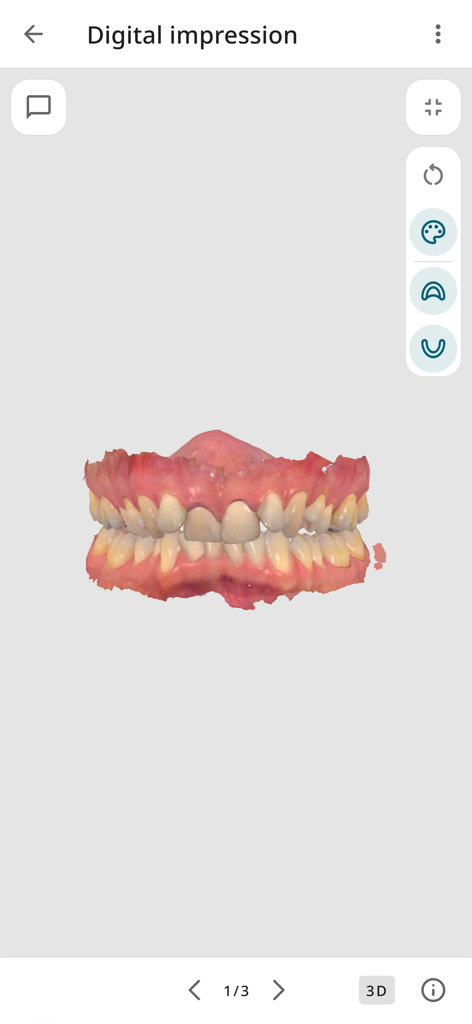 3Shape Unite Cloud - 3D digital dental impression scan view in the 3Shape Unite Cloud mobile app
