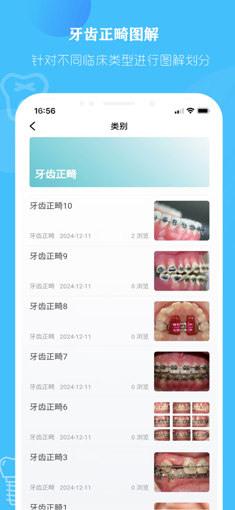 口腔解剖图 — 口腔牙科精美科普全息插图 - Una schermata dell'app mobile che visualizza un elenco di casi clinici ortodontici con miniature di apparecchi ortodontici e allineamenti.