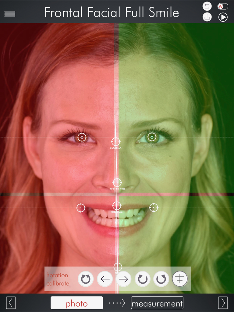 DSD App - DSD App interface showing frontal facial smile analysis with alignment markers and facial symmetry grid