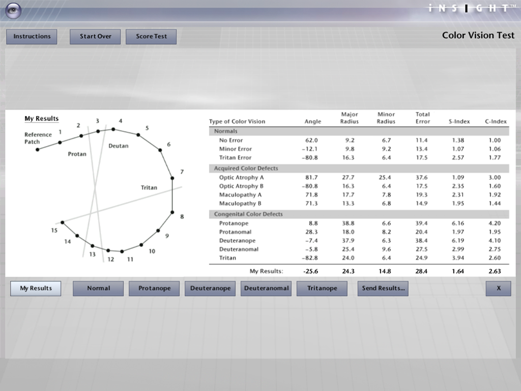 iNSIGHT Color Vision Test | Clinical Lab for Vision Science
