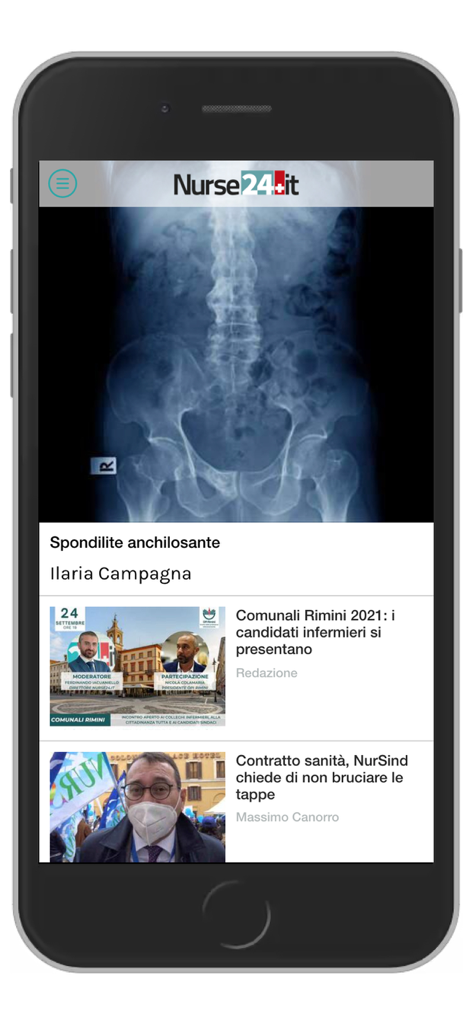 Nurse24.it mobile app interface displaying nursing news articles and a clinical X-ray image.
