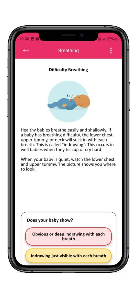 The Lullaby Trust Baby Check - Screenshot of the Baby Check app interface for assessing infant breathing difficulty with descriptive text and risk options.