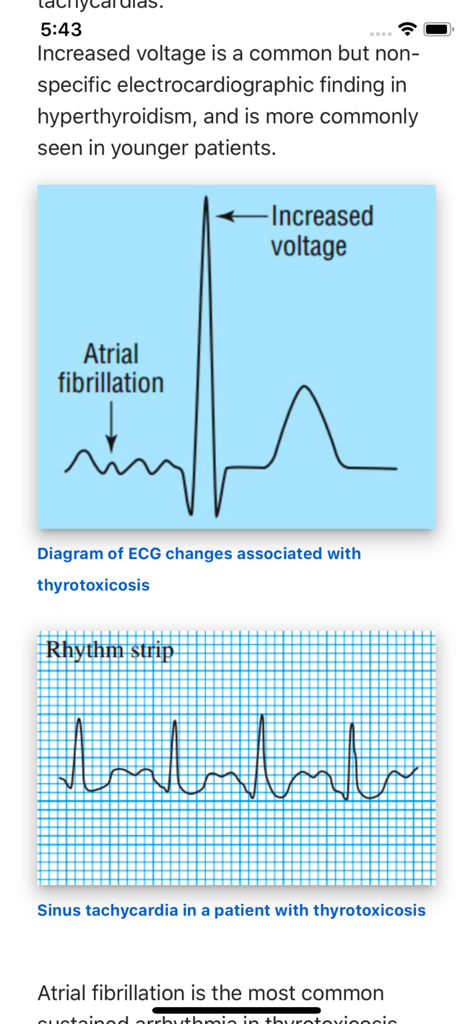 ECG Basics Lite: ECG Made Easy - Medical App | MWM