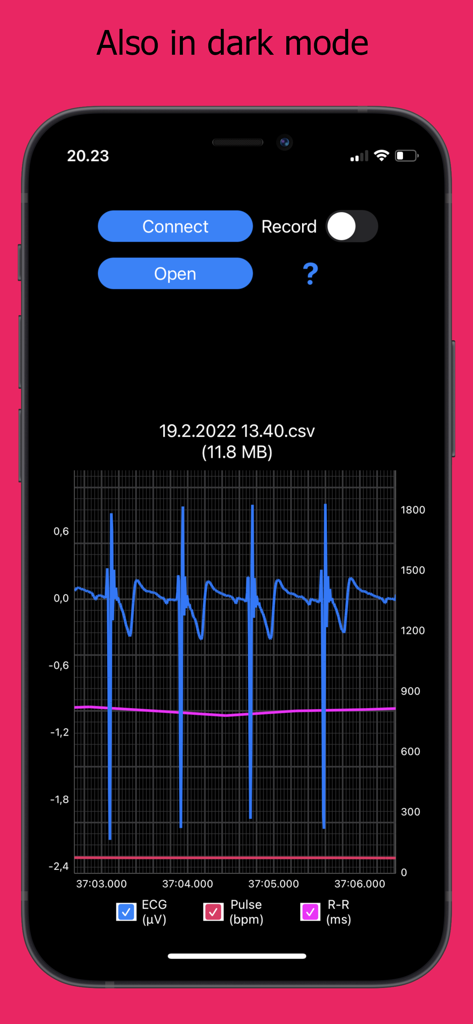ECG Logger for Polar H10 - ECG Logger for Polar H10 app interface in dark mode showing live heart data graphs.