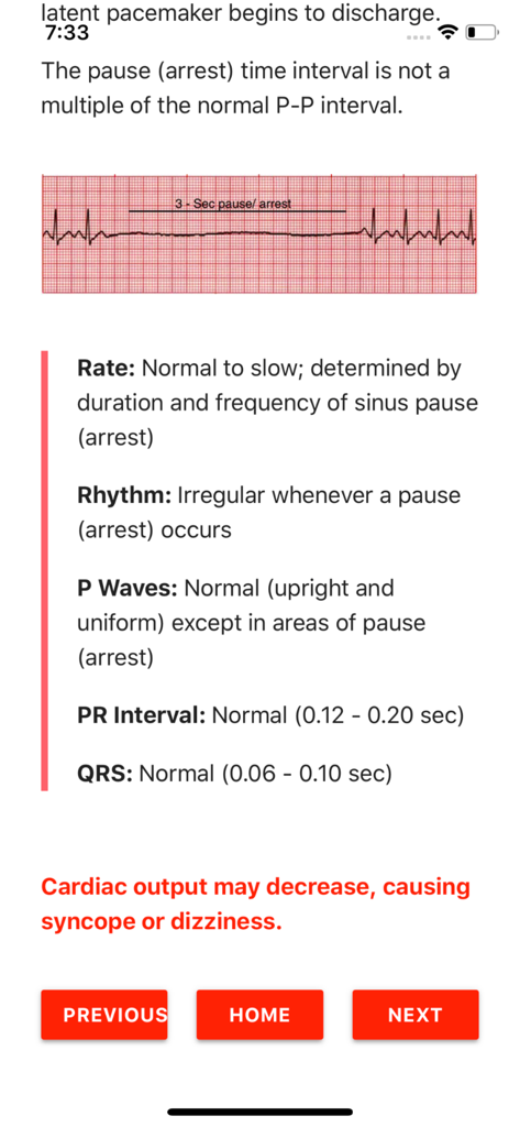 ECG FlashCards - Detailed view of a sinus arrest rhythm strip and clinical characteristics in the ECG FlashCards app