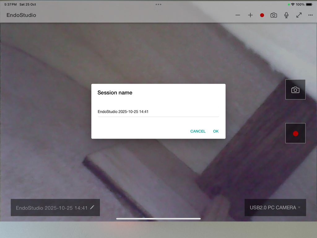 EndoStudio - Interfaz de la aplicación EndoStudio en un iPad mostrando un cuadro de diálogo de nombre de sesión sobre una vista de cámara de endoscopio en vivo.