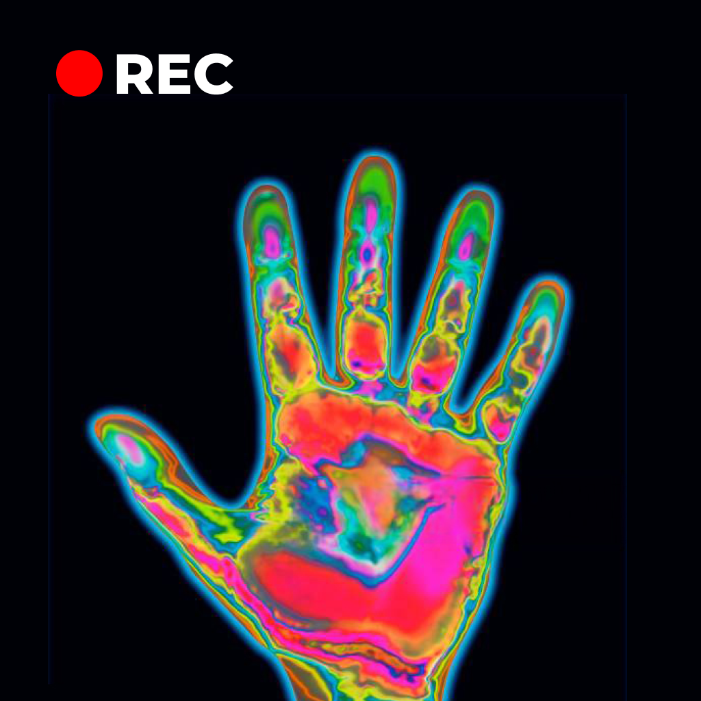 Heat Sensor Camera - Reference App | MWM