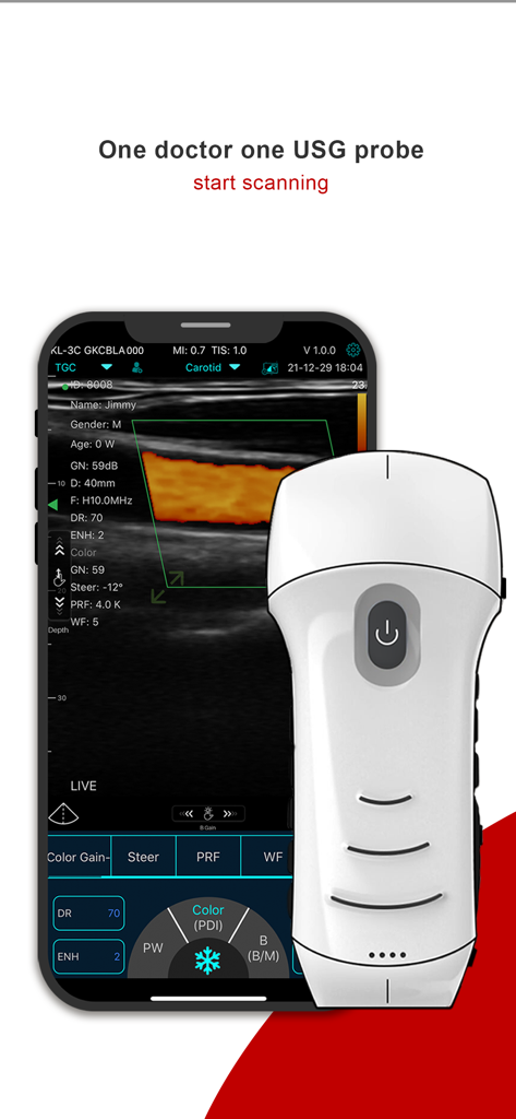 MY USG - Una sonda de ultrasonido inalámbrica de mano junto a un teléfono inteligente que muestra un escaneo de la arteria carótida en la interfaz de la aplicación MY USG