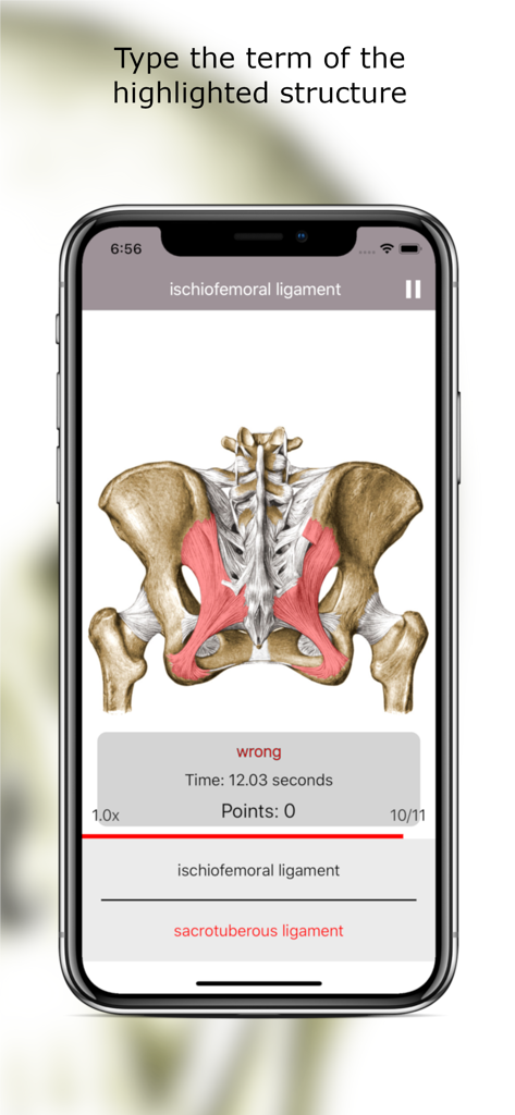 Anatomy Quiz Lite - Anatomy Quiz Lite app interface showing a typing challenge to identify pelvic ligaments on a medical illustration.