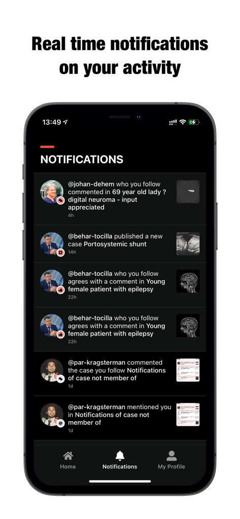 Collective Minds - Notifications d'activité en temps réel pour les cas de radiologie sur l'application mobile Collective Minds.