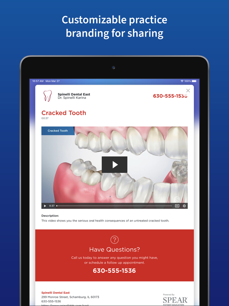 Spear Patient Education - iPad showing a dental education video about a cracked tooth with customized practice branding for a dentist