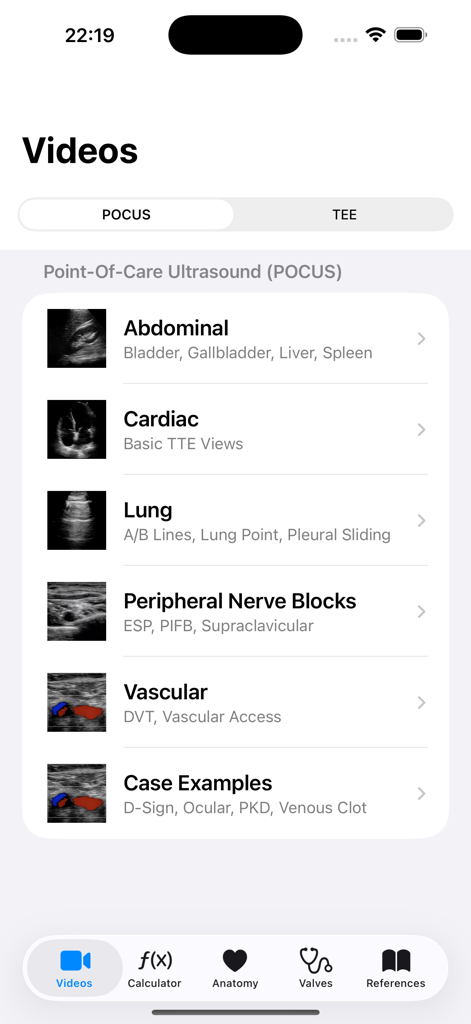 EchoRef mobile app screen showing educational video categories for Point-of-Care Ultrasound including cardiac lung and vascular ultrasound