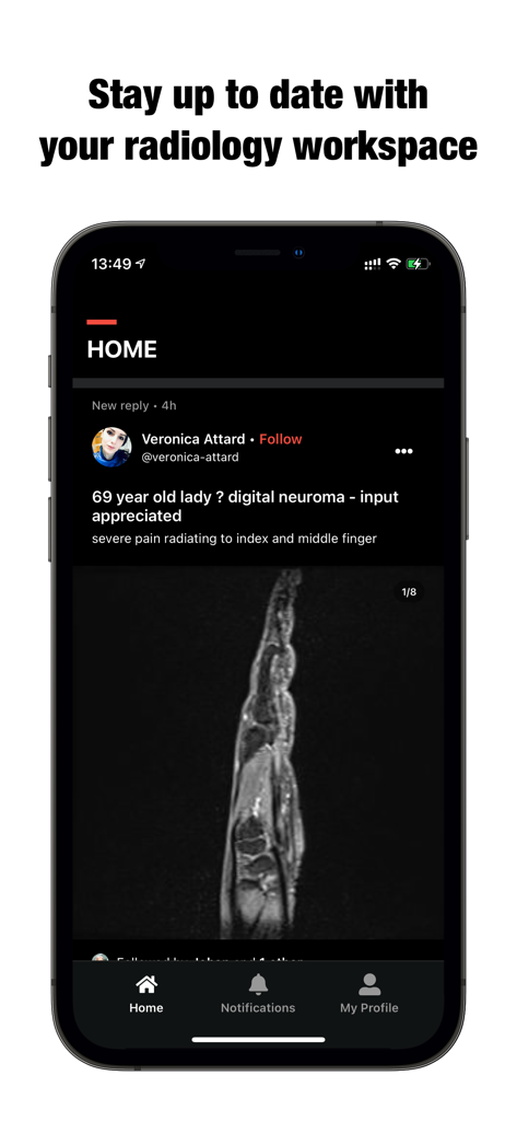 Collective Minds - Écran d'accueil de l'application Collective Minds montrant une discussion de cas de radiologie avec une image médicale numérisée.