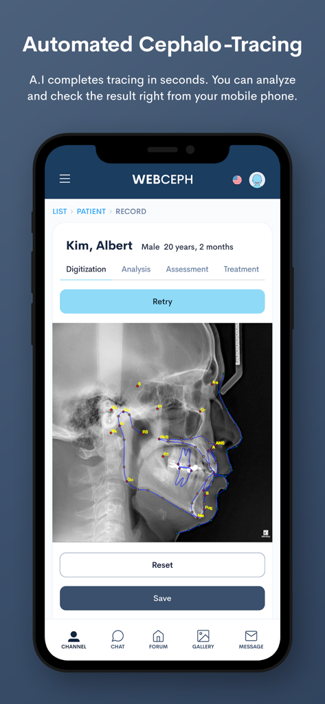 WebCeph - Automated cephalometric tracing and AI analysis on the WebCeph mobile app.