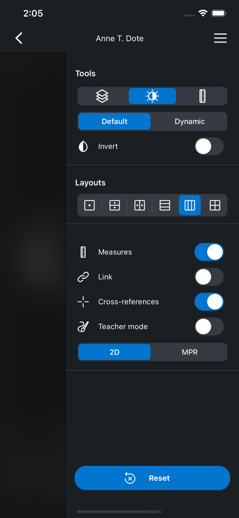 Tool menu and layout options in the IDV medical imaging app