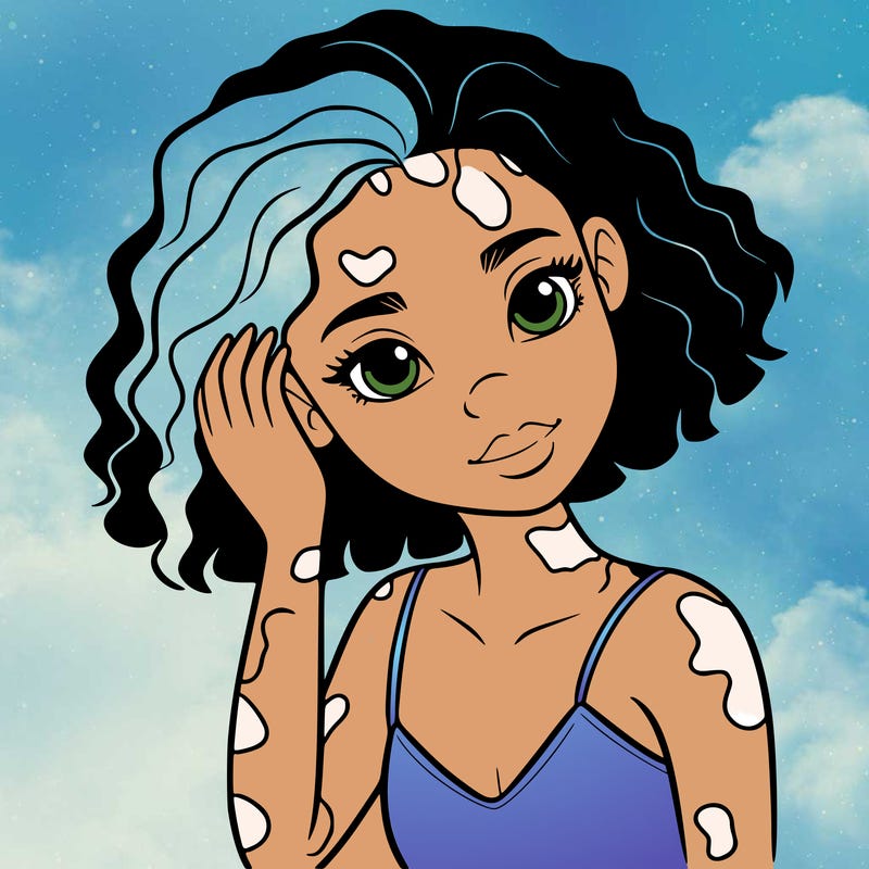 vitiligo black girl