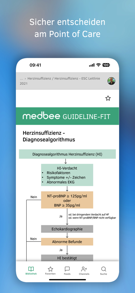 Medbee - Smartphone screen showing a heart failure diagnostic flowchart in the Medbee clinical decision support app