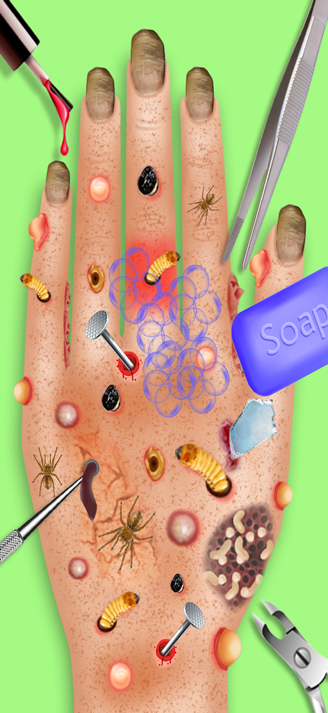A hand with various medical issues like parasites and dirty nails being treated with tools in the ASMR Doctor game.