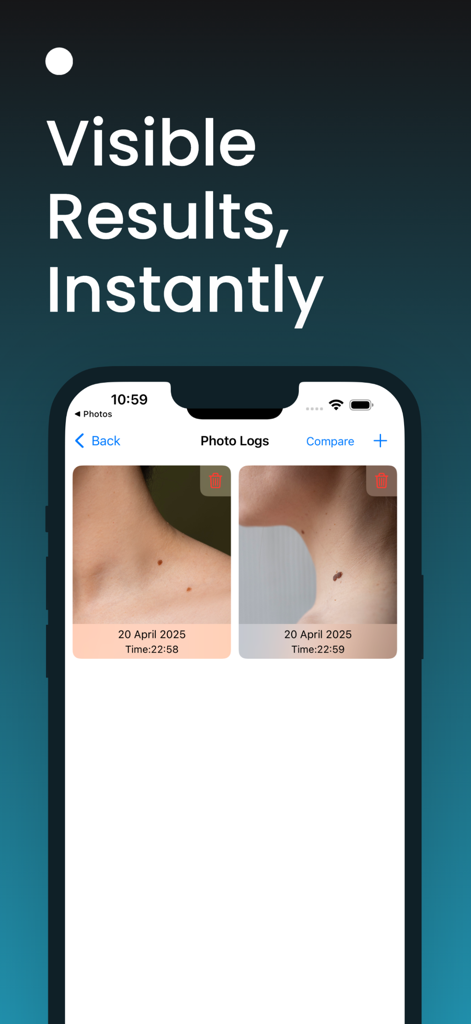 AI Skin Scanner: Skincare Time - AI Skin Scanner app interface showing photo logs of skin spots for tracking and monitoring changes