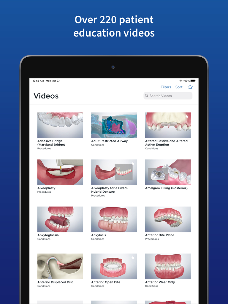 Spear Patient Education - A library of over 220 patient education videos for dental procedures and conditions on an iPad