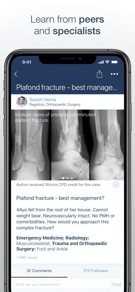 MedShr: The App for Doctors - MedShr app interface showing an orthopedic clinical case with X-rays and peer discussion