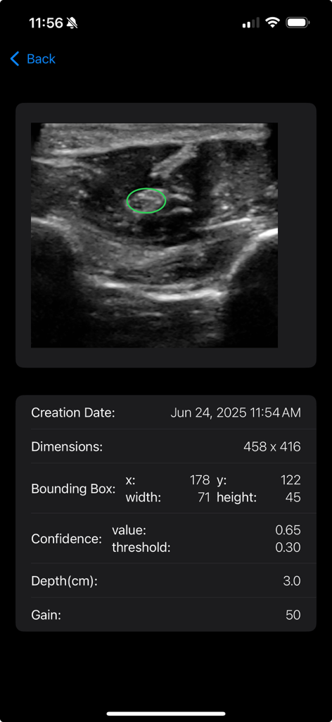 MSK VUE - An ultrasound scan in the MSK VUE app featuring an AI-identified structure with technical metadata including confidence level and depth.