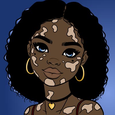 bleautiful black girl with vitiligo