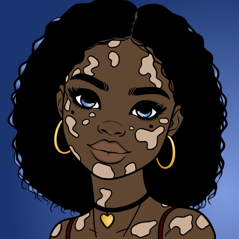 bleautiful black girl with vitiligo