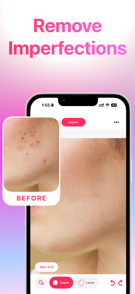 전후 비교를 통해 피부 결점 제거를 보여주는 사진 편집 앱 인터페이스