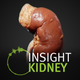 INSIGHT KIDNEY