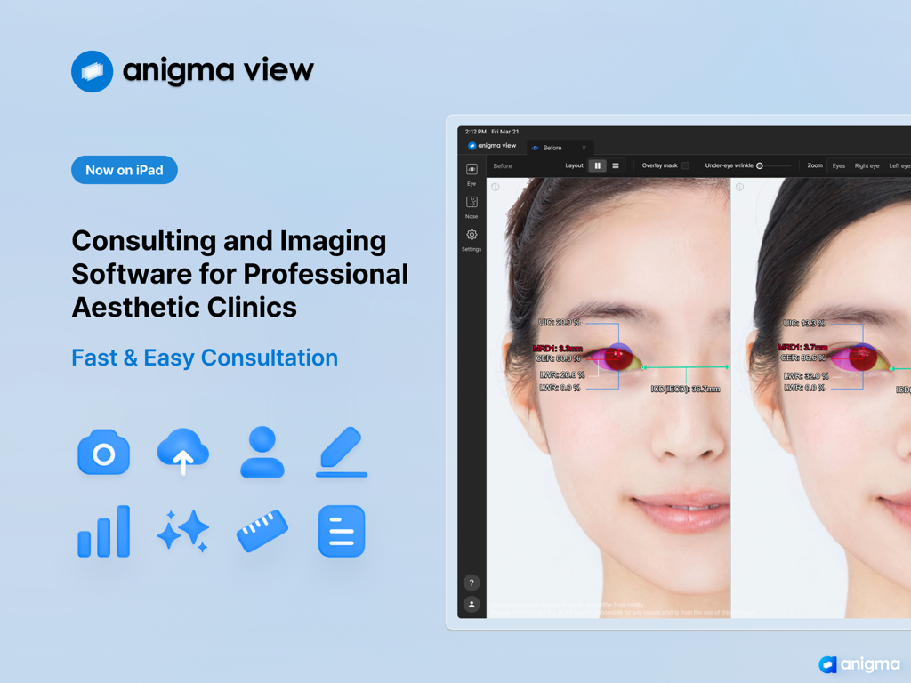 Anigma View - Anigma View AI medical imaging software interface on iPad for professional aesthetic clinic consultations