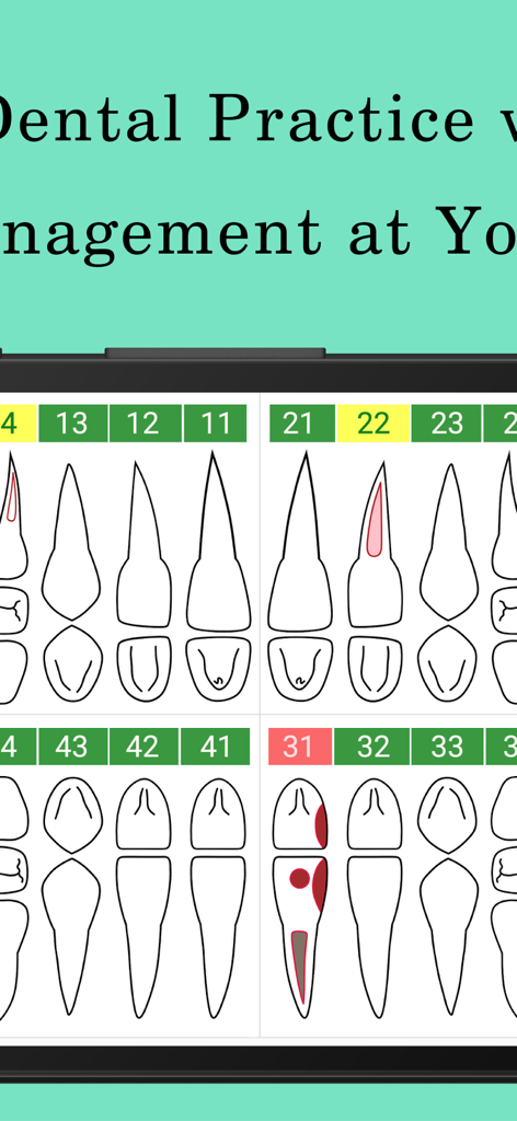 Dentabros - Dental Software - 치아 번호 지정 및 임상 표시를 보여주는 DentaBros 앱 내 디지털 치과 차트