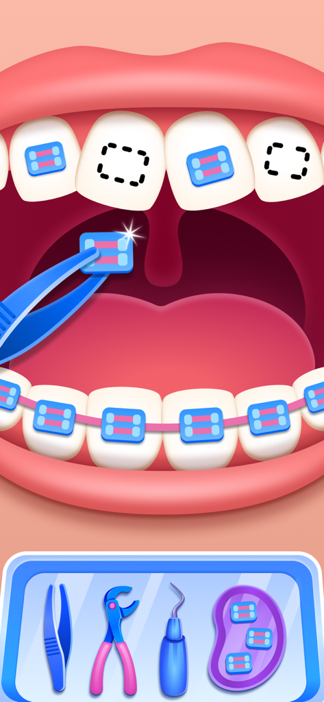 Dentist Baby Games for Kids - Colocando aparatos ortopédicos azules en los dientes en un juego de dentista para niños