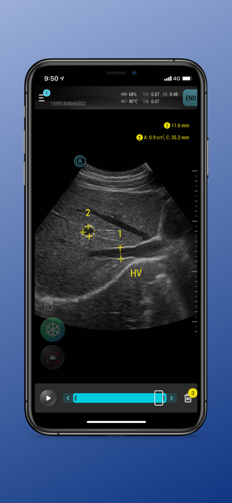 Aco Apache App - Medical App | MWM