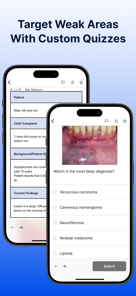 Dental Boards Mastery INBDE app interface showing a clinical patient box question with a diagnostic image